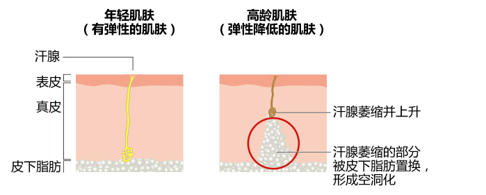 年轻肌肤（有弹性的肌肤）高龄肌肤（弹性降低的肌肤）