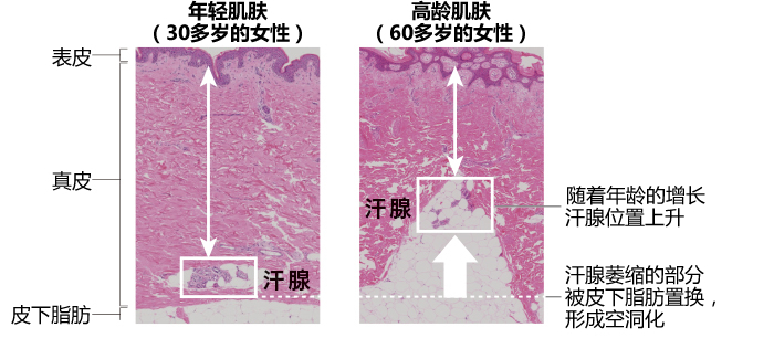 年轻肌肤（30多岁的女性）高龄肌肤（60多岁的女性）
