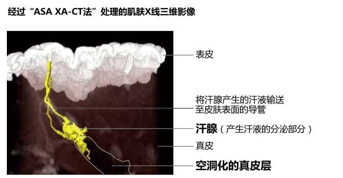 经过“ASA XA-CT法”处理的肌肤X线三维影像