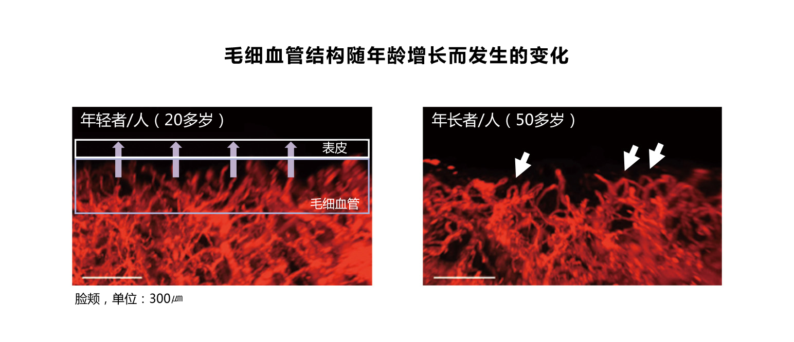 毛细血管结构随年龄增长而发生的变化